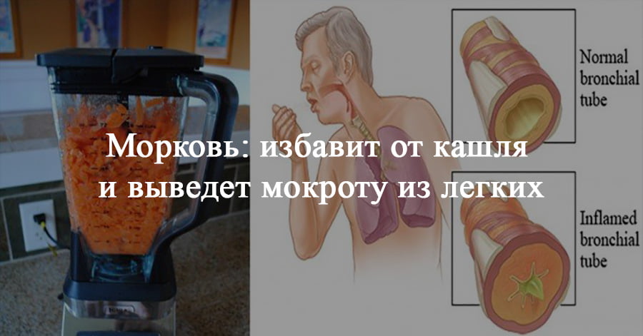 35Как лечить кашель курильщика в домашних