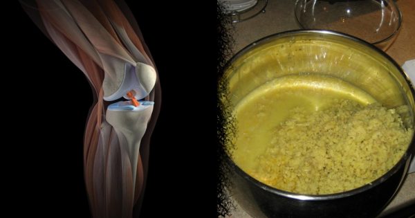 Как лечить коленный сустав